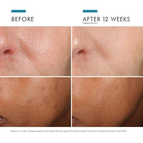 SkinCeuticals Phloretin CF Vitamin C Serum