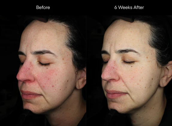 ( plated ) INTENSE Serum