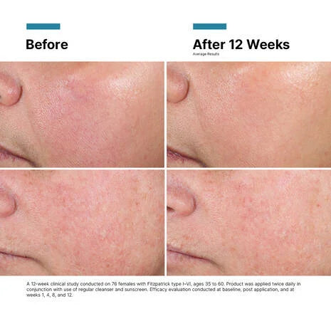 SkinCeuticals Advanced RGN-6