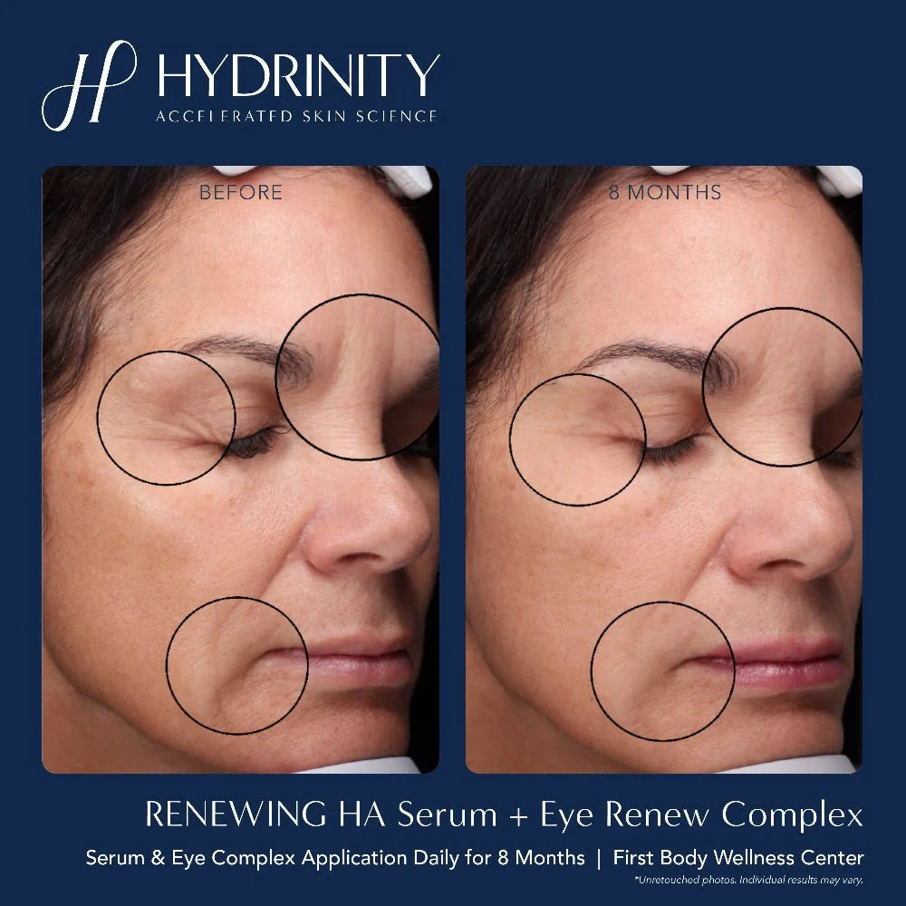 Hydrinity Eye Renew Complex