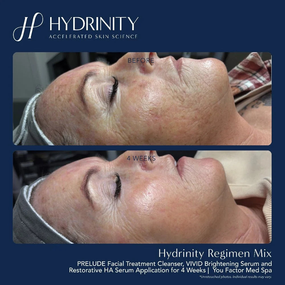 Hydrinity Restorative HA Serum