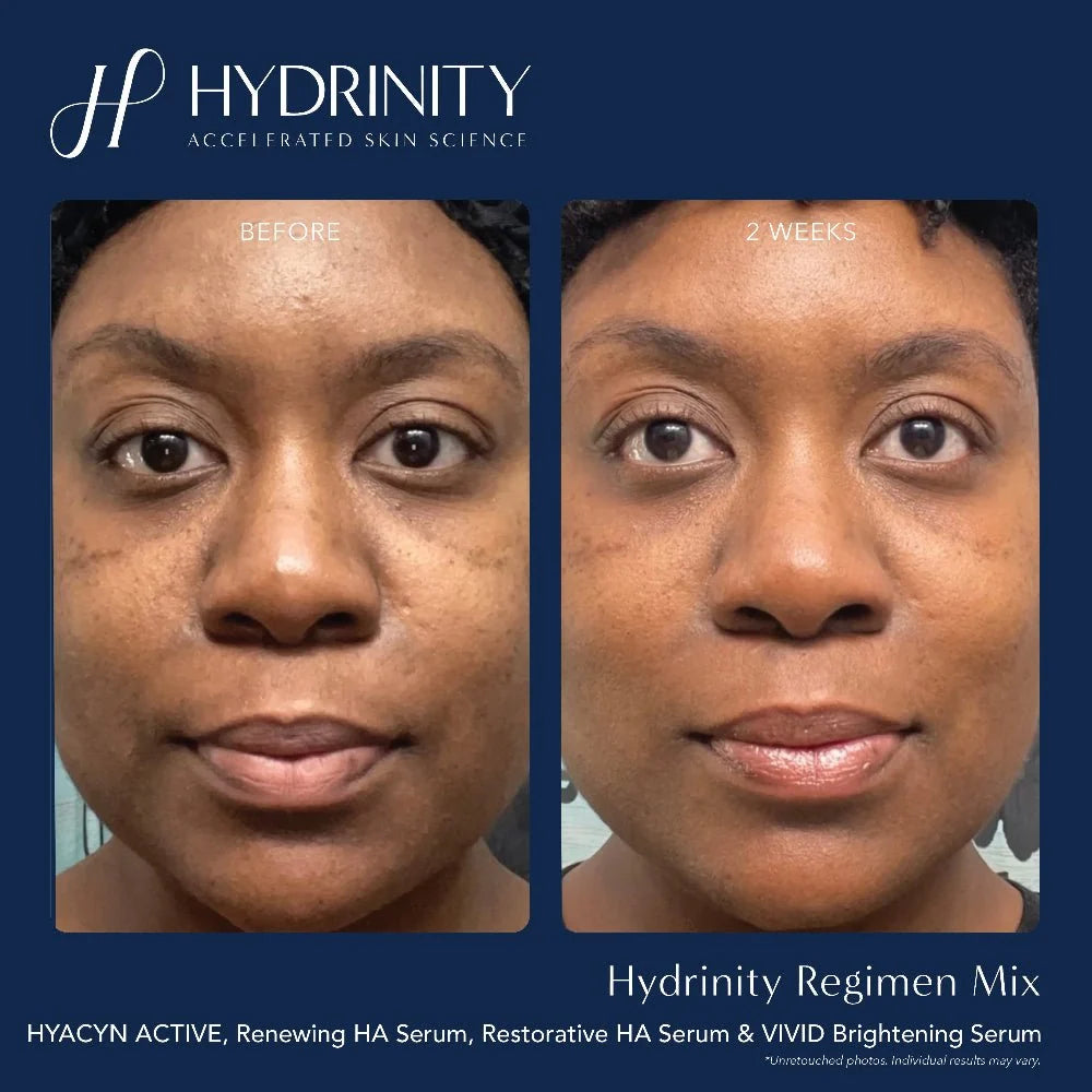 Hydrinity Restorative HA Serum